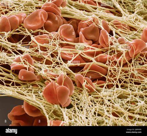 fibrin